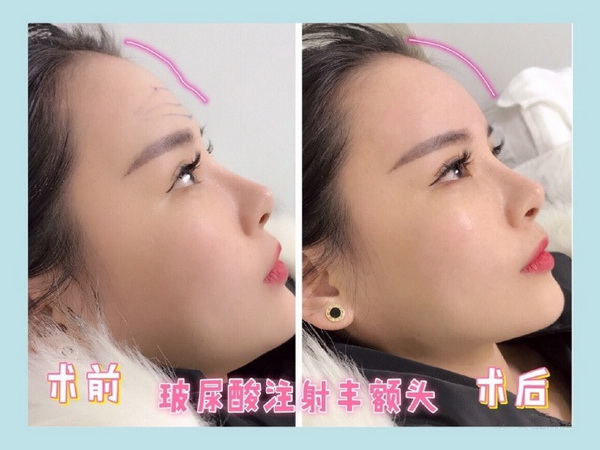 上海专业网红整形|上海整形修复医院 