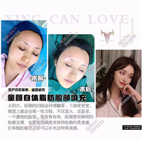 上海星璨哪个医生好 