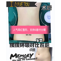 上海星璨整形@上海做大腿抽脂整形多少钱 