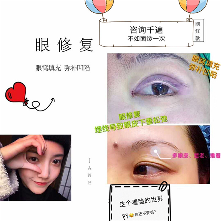 上海眼整形修复@上海做眼综合整形修复