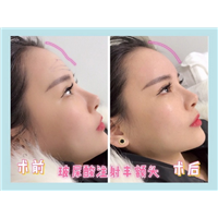 上海专业网红整形|上海整形修复医院 