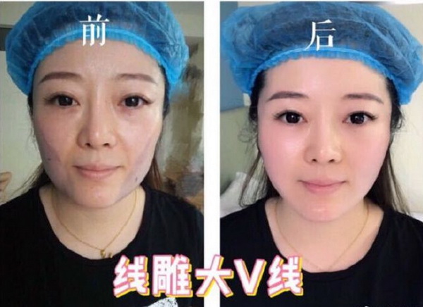 上海整形修复医院|上海医美联盟 