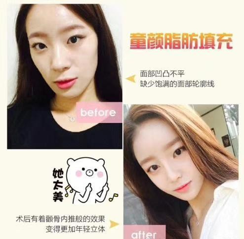 上海整形修复医院|上海医美联盟 
