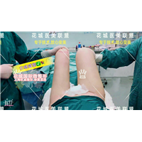 上海星璨国际整形医院 大腿环吸术 