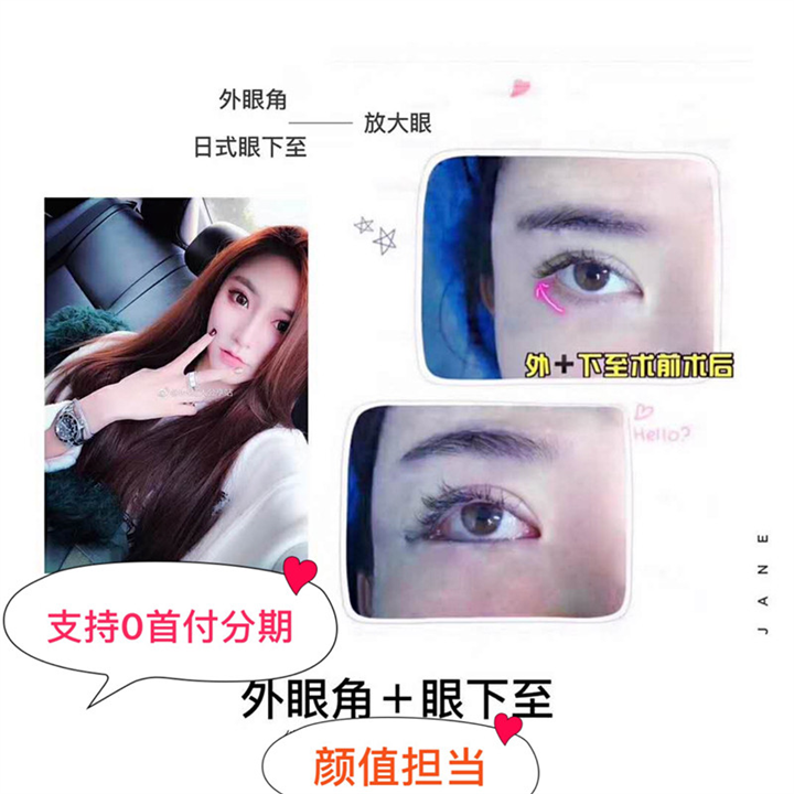 上海眼部整形失败修复医院