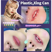 上海星璨是正规医院吗