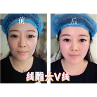 上海整形修复医院|上海医美联盟 