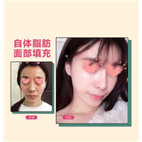 上海专业网红整形|上海整形修复医院 