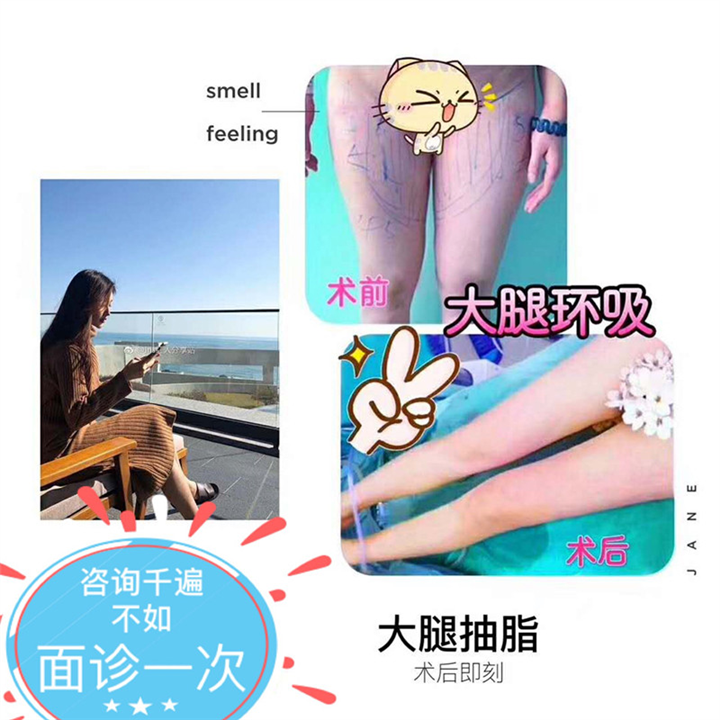大腿环吸术后即刻