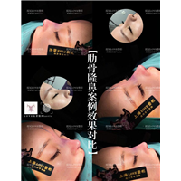 上海星璨口碑