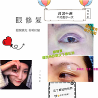 上海眼整形修复@上海做眼综合整形修复