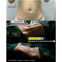 上海美若星辰整形