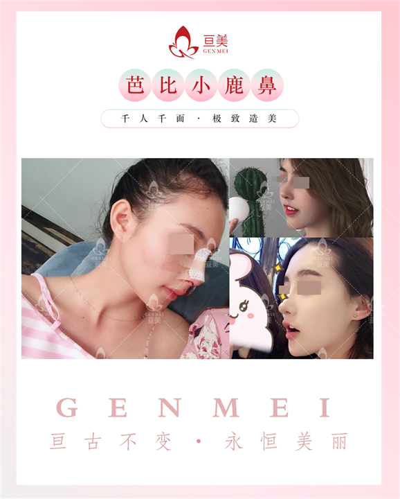 南昌鼻修复