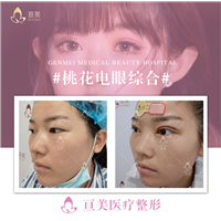 南昌眼综合