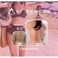 南昌抽脂整形