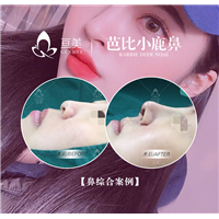 南昌亘美小翘鼻