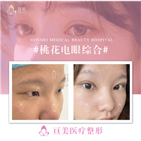 南昌眼综合整形