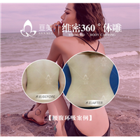 南昌吸脂整形哪家好