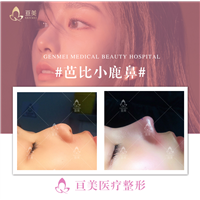 亘美医疗整形芭比小鹿鼻