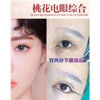 南昌眼综合