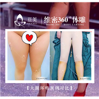 南昌大腿环吸案例