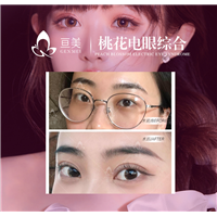 南昌眼综合整形哪家好