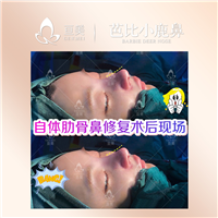南昌自体肋骨鼻修复术