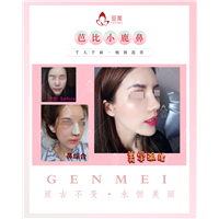 南昌肋骨鼻整形医院