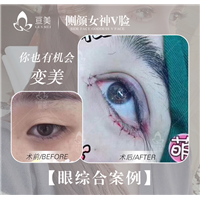 亘美医疗眼综合案例