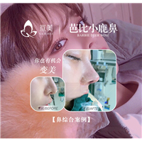 南昌鼻综合整形