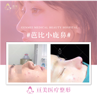 南昌鼻整形医院