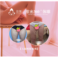 南昌亘美医疗大腿环吸案例
