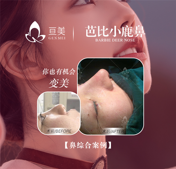 南昌做整形多少钱