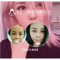 南昌眼整形哪家好