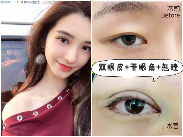湖南眼综合整形医生 