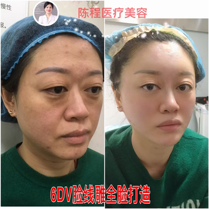 湖南线雕整形 
