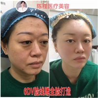 湖南线雕整形 