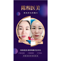 益阳面部线雕美容 