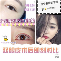 益阳割双眼皮哪家好 