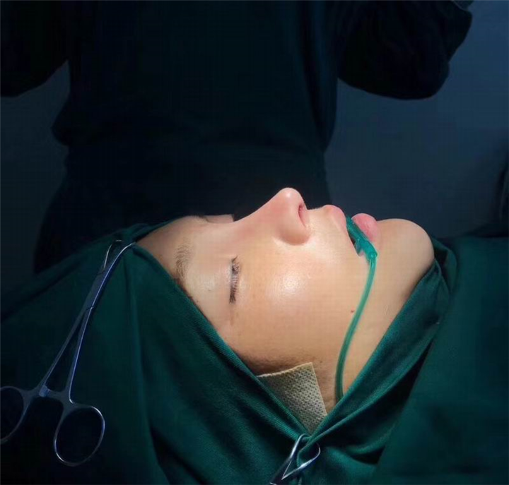 益阳假体隆鼻 