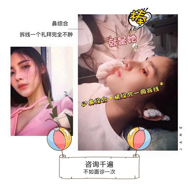 整形医师陈巧 