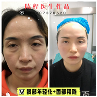 益阳线雕整形 