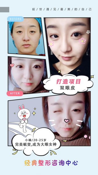 益阳眼综合整形 