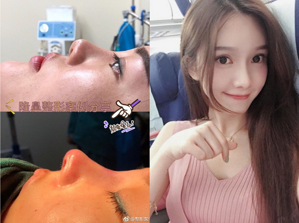 湖南益阳陈程医疗美容诊所 