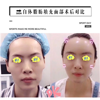 陈巧医生 