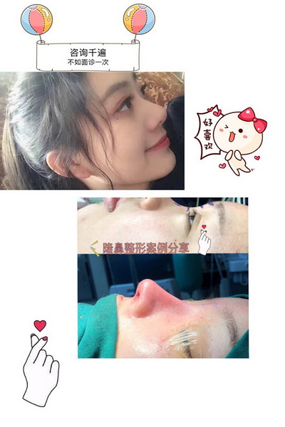 益阳做鼻子哪里好 