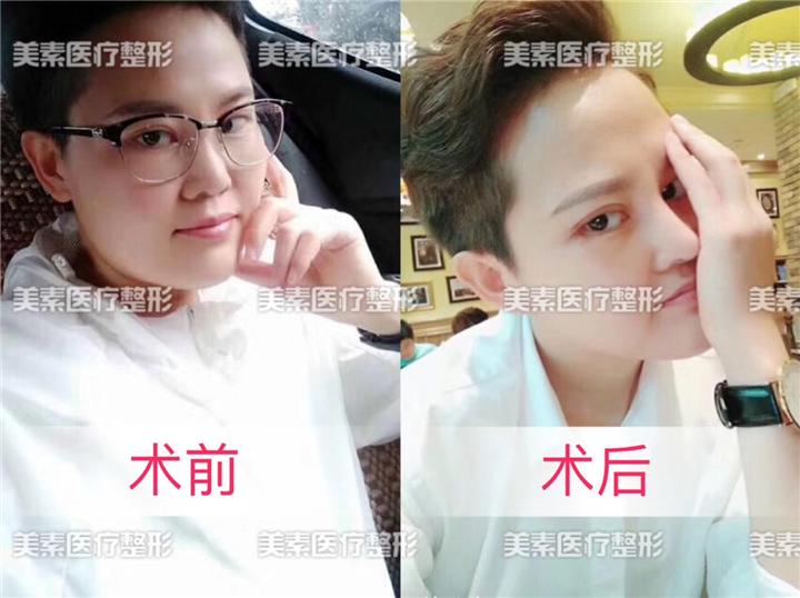 河南整形医院哪家好 