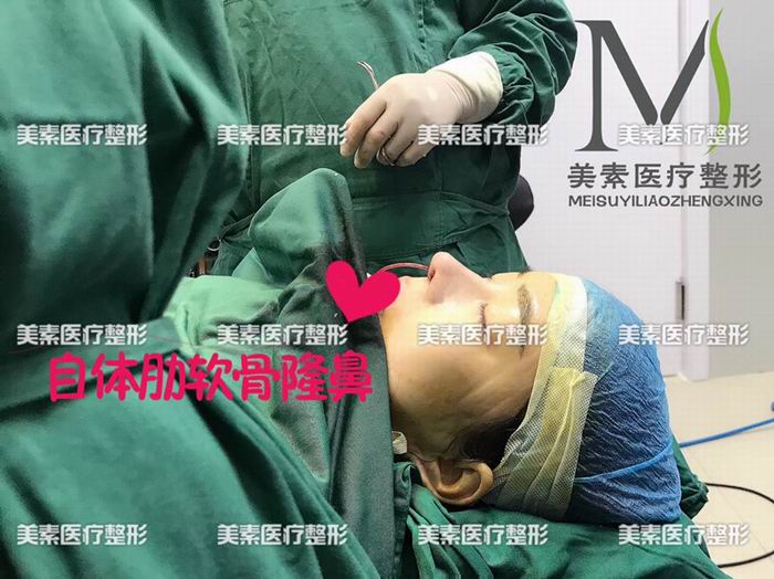 郑州美素整形医院→郑州整形医院哪家好 
