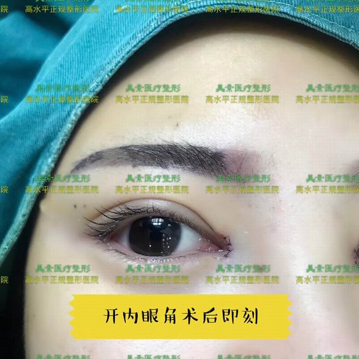 郑州整形医院哪家专业→郑州鼻综合整形 