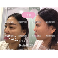 郑州整形医院哪家好→郑州整形医院哪家专业 